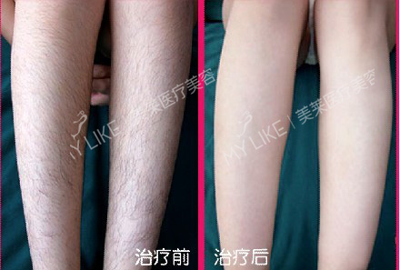 201504300340064189.jpg