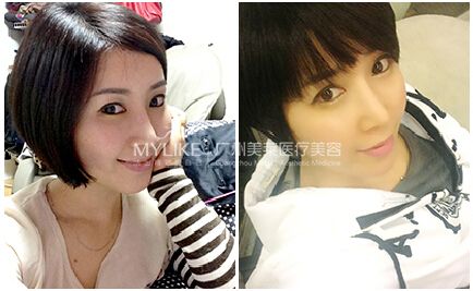 留住青春，我有妙招3.jpg
