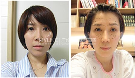 留住青春，我有妙招1.jpg