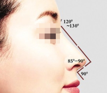 假体隆鼻手术安不安全