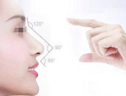 综合隆鼻的恢复期是多久