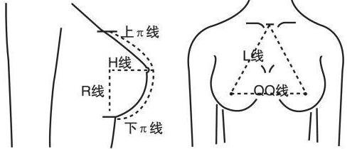 假体隆胸多久更换假体比较好