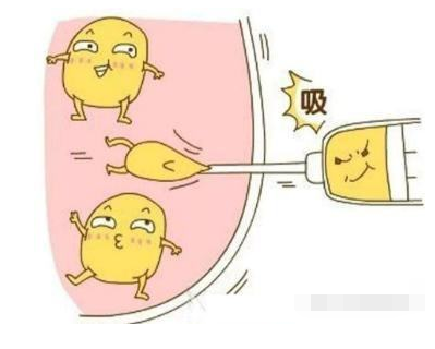 腰腹部抽脂减肥的价格是多少