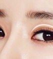 全切双眼皮会影响视力健康吗