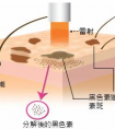 自体脂肪填充面部需要多少钱